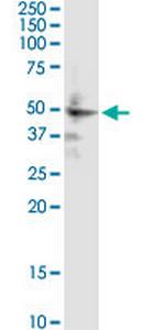 ZIC1 Antibody in Western Blot (WB)