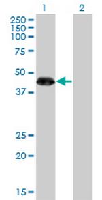 ZNF3 Antibody in Western Blot (WB)