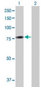 ZNF7 Antibody in Western Blot (WB)