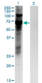 ZNF10 Monoclonal Antibody (1E1)