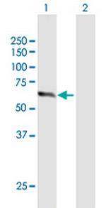 ZNF18 Antibody in Western Blot (WB)