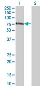 ZNF18 Monoclonal Antibody (2A4)