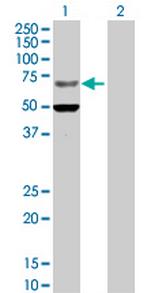 ZNF182 Polyclonal Antibody, MaxPab™