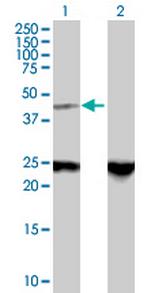 ZNF24 Polyclonal Antibody, MaxPab™