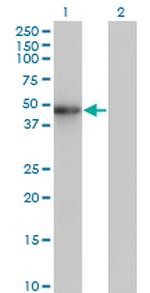 ZNF24 Antibody in Western Blot (WB)