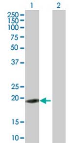 ZNF26 Polyclonal Antibody, MaxPab™