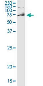 ZNF28 Monoclonal Antibody (8H6)