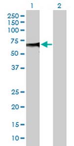 ZSCAN20 Polyclonal Antibody, MaxPab™