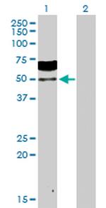 ZSCAN20 Antibody in Western Blot (WB)