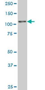 ZNF31 Antibody in Western Blot (WB)