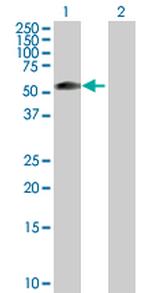 ZSCAN21 Polyclonal Antibody, MaxPab™