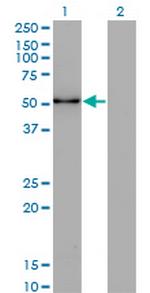 ZSCAN21 Monoclonal Antibody (4F10)