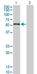 ZSCAN21 Monoclonal Antibody (2A8)