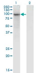 ZNF41 Antibody in Western Blot (WB)