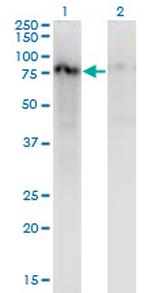 ZNF41 Antibody in Western Blot (WB)