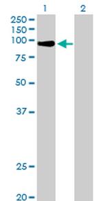 ZNF42 Antibody in Western Blot (WB)