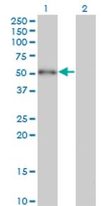 ZBTB25 Antibody in Western Blot (WB)