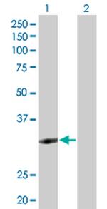 ZNF124 Antibody in Western Blot (WB)
