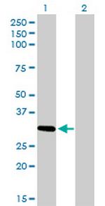 ZNF124 Antibody in Western Blot (WB)