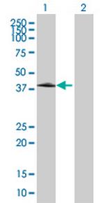 ZNF134 Polyclonal Antibody, MaxPab™