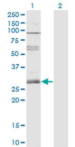 ZNF138 Monoclonal Antibody (4D11)