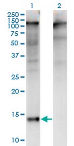 ZBTB16 Monoclonal Antibody (3A7)