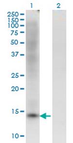 ZBTB16 Monoclonal Antibody (1F10)