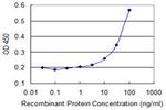 ZNF157 Monoclonal Antibody (3G3)