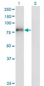 ZNF175 Monoclonal Antibody (1C2)