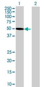 RNF113A Antibody in Western Blot (WB)
