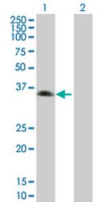 ZNF187 Antibody in Western Blot (WB)
