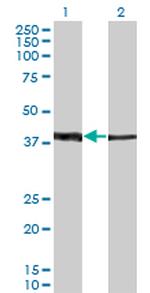 ZNF187 Antibody in Western Blot (WB)