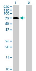 ZNF189 Polyclonal Antibody, MaxPab™