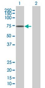 ZNF192 Antibody in Western Blot (WB)