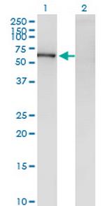 ZNF192 Antibody in Western Blot (WB)