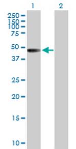 ZNF193 Polyclonal Antibody, MaxPab™