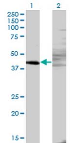 ZNF193 Monoclonal Antibody (3G6)