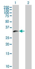 ZNF215 Polyclonal Antibody, MaxPab™