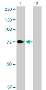 ZYX Antibody in Western Blot (WB)