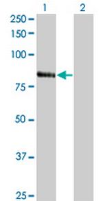 RNF103 Monoclonal Antibody (3E7)