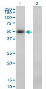 PAX8 Antibody in Western Blot (WB)