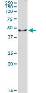 IL1R2 Polyclonal Antibody, MaxPab™