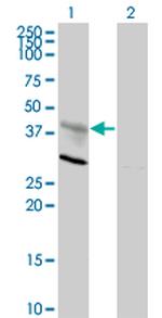 CXCR4 Monoclonal Antibody (2H5)