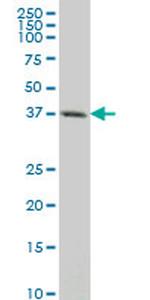 CXCR4 Monoclonal Antibody (1F8)
