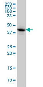 MAPKAPK3 Monoclonal Antibody (3F4)
