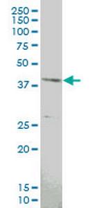 MAPKAPK3 Monoclonal Antibody (4B11)