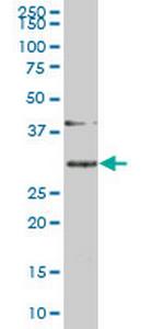 SLBP Monoclonal Antibody (2C4-1C8)