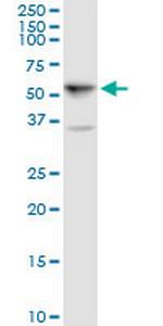 ALDH5A1 Polyclonal Antibody, MaxPab™