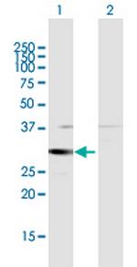 HSD17B8 Polyclonal Antibody, MaxPab™