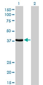 EPM2A Monoclonal Antibody (6C6)